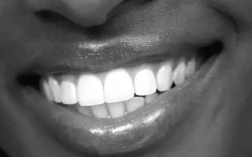 „So Schützen Sie Ihre Zähne Vor Flecken – Ohne Auf Wein oder Kaffee Zu Verzichten“